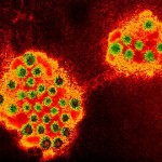 Norovirus