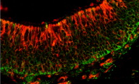 Determinan un factor clave del desarrollo neuronal