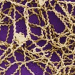 Bacteria