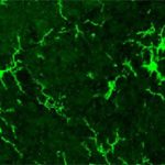 Los científicos identificaron en experimentos con ratones un mecanismo de “resiliencia” cerebral durante la gestación que protegería a las niñas frente al autismo.