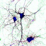 Los científicos del CONICET y de la UNSAM confirmaron el papel clave de la glicoproteína (proteína unida a azúcares) M6a en la comunicación entre células nerviosas. El hallazgo podría servir en el futuro para el diagnóstico precoz o la identificación de personas predispuestas a distintas patologías psiquiátricas y neurológicas. 