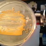 Placa de petri con colonias bacterianas anaranjadas de Xanthomonas campestris, una bacteria que causa la “podredumbre negra” en repollo, nabo, coliflor y otras crucíferas. 