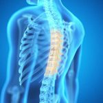 El avance científico sienta bases para mejorar el diagnóstico de la osteoporosis. 