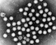 Detectan en Argentina una variante inusual de un virus que causa náuseas y diarrea