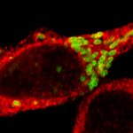 Imagen microscópica de la bacteria de la brucelosis (color verde) reproduciéndose en el interior de un glóbulo blanco de ratón (color rojo). El estudio liderado en el Instituto Leloir sienta bases para el desarrollo futuro de terapias eficaces.   Créditos: R. Sieira.