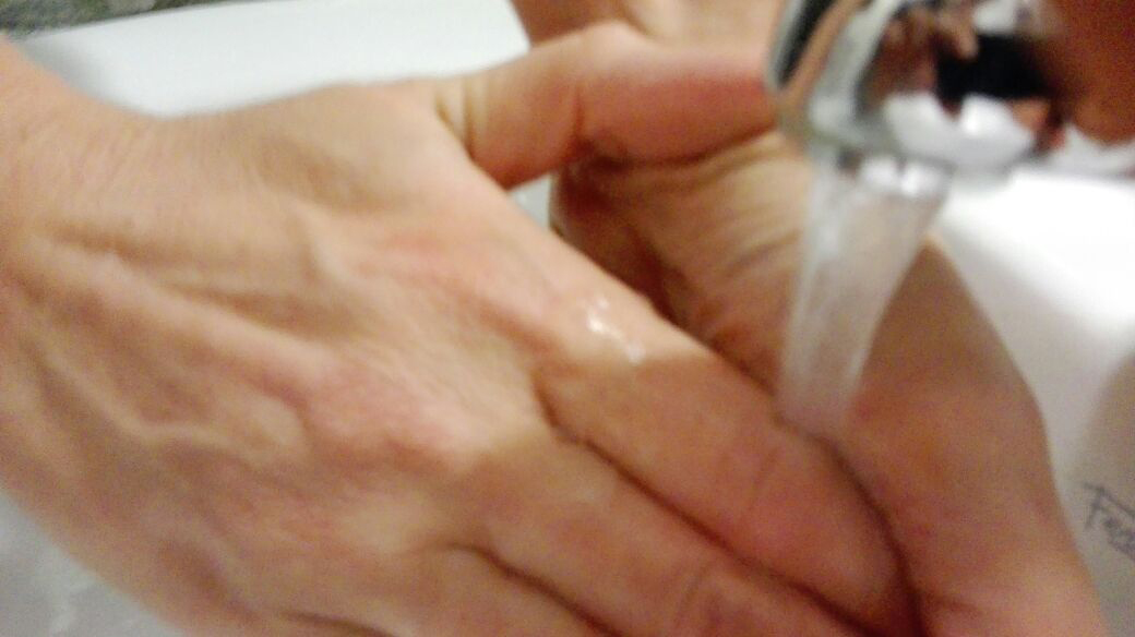 Para combatir a las superbacterias, la medida más simple: lavarse las manos