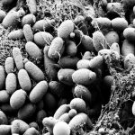 Imagen de la bacteria probiótica Streptococcus thermophilus CRL1190, cepa que podría anular o limitar el rol patógeno de otro microorganismo, Helicobacter pylori, causante de gastritis y úlceras.  