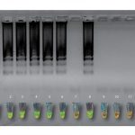 Luego del ensayo, el ADN amplificado del Trypanosoma cruzi en las muestras positivas (1-6) se detecta mediante la técnica de electroforesis, que genera el patrón “chorreado”, o por el cambio de color.