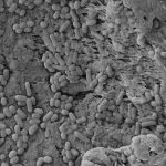 Microscopia electrónica del biofilm de Listeria monocytogenes, un patógeno de las heladeras. 