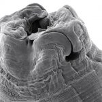 Imagen microscópica del parásito que pone en riesgo la salud del ñandú petiso.  Créditos: Gentileza de la Dra. Estefanía Bagnato 