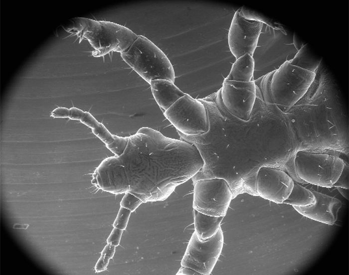 Desarrollan nanocápsulas efectivas contra los piojos
