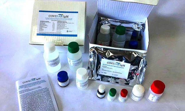 ANMAT aprueba un nuevo test serológico nacional que mide otro anticuerpo contra el coronavirus