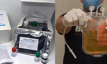 “COVIDAR IgG”: test serológico clave en los estudios de plasma de convalecientes