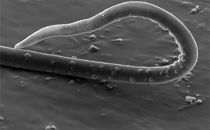 Parásito disruptivo: el “gusano látigo” podría alterar la microbiota intestinal