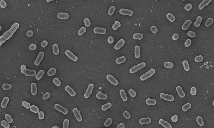 Visualizan cómo la luz azul “enciende” la virulencia de las bacterias de la brucelosis