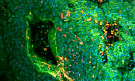 Proteína de bacteria que causa la brucelosis podría mejorar la inmunoterapia contra el melanoma