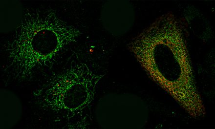 Descubren el papel fundamental de una proteína para que las células puedan renovar sus componentes