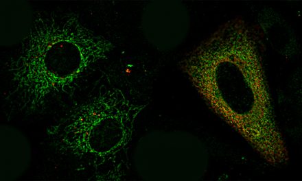 Descubren el papel fundamental de una proteína para que las células puedan renovar sus componentes