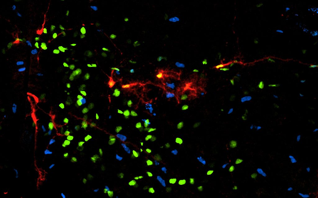 Más allá de las neuronas: determinan cómo se originan ciertas células del sistema nervioso central, claves para el funcionamiento de los circuitos neuronales