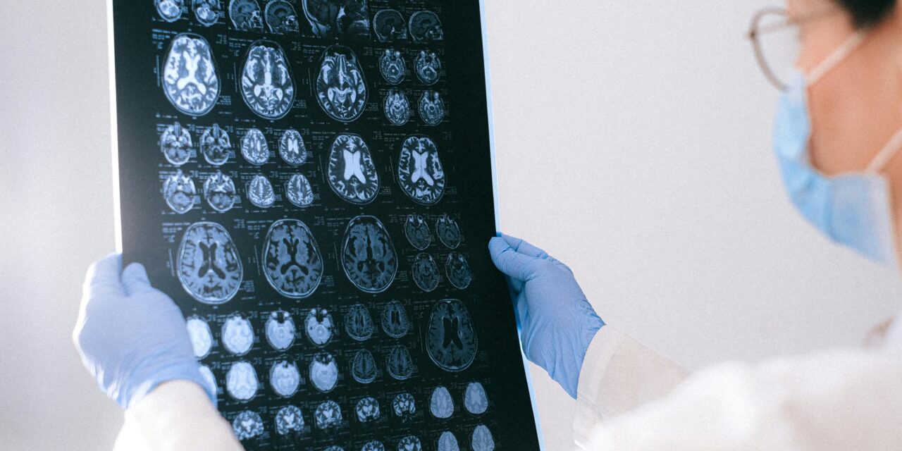 Identifican en sangre biomarcadores relevantes para diagnóstico y seguimiento de pacientes con epilepsia