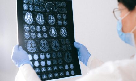 Identifican en sangre biomarcadores relevantes para diagnóstico y seguimiento de pacientes con epilepsia
