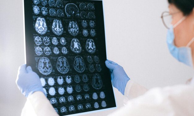 Identifican en sangre biomarcadores relevantes para diagnóstico y seguimiento de pacientes con epilepsia