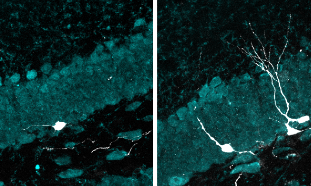 La estimulación con luz y sonido intermitentes promueve el desarrollo de nuevas neuronas en cerebros envejecidos