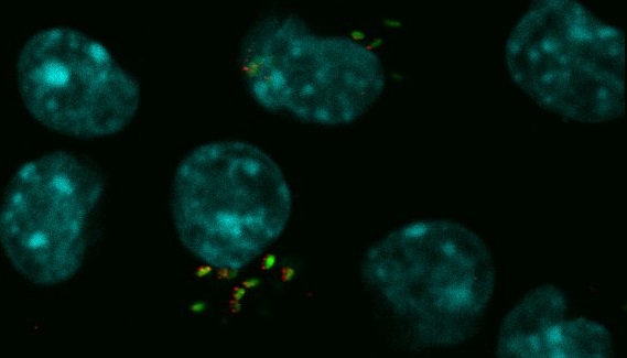 Descubren una “estrategia” energética de la bacteria de la brucelosis para optimizar su multiplicación