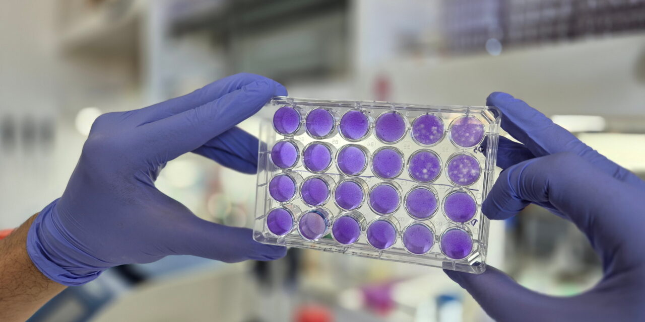 Hallan un mecanismo común de replicación de los virus del dengue, Zika y fiebre amarilla, que podría inspirar un antiviral de “amplio espectro”
